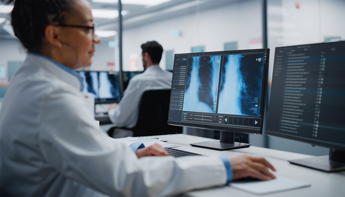 Customized Lung Cancer Care Tailored Just for You