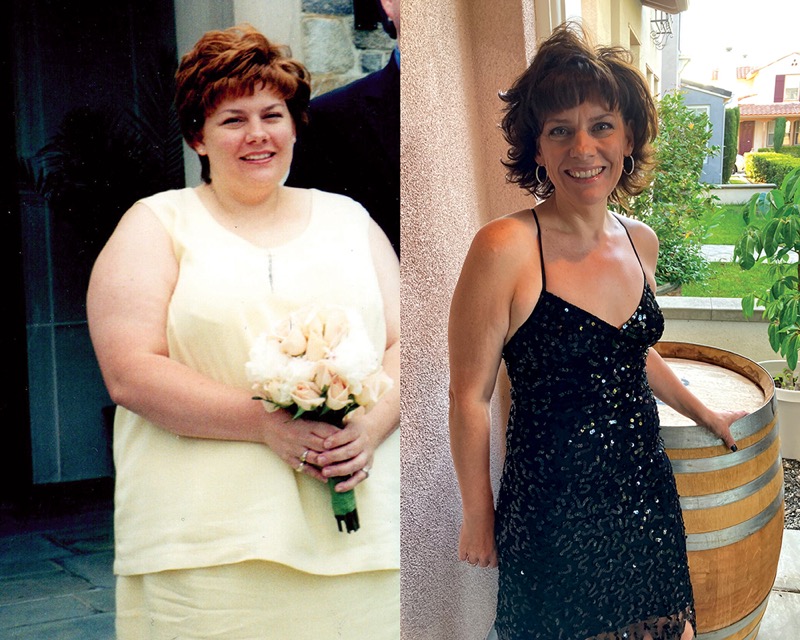 Dina Miller, Before and After Gastric Sleeve Surgery