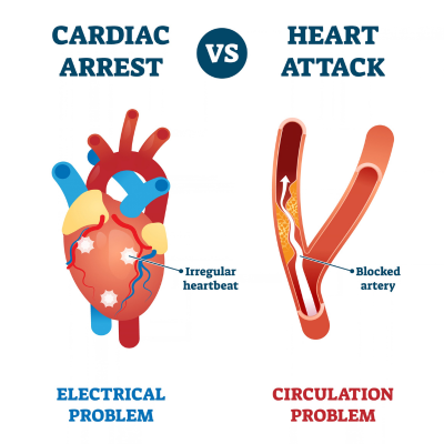 Image showing how cardiac arrest is caused by an electrical problem while heart attack is shown from a blockage in the vessels.
