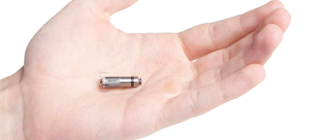Pacemaker