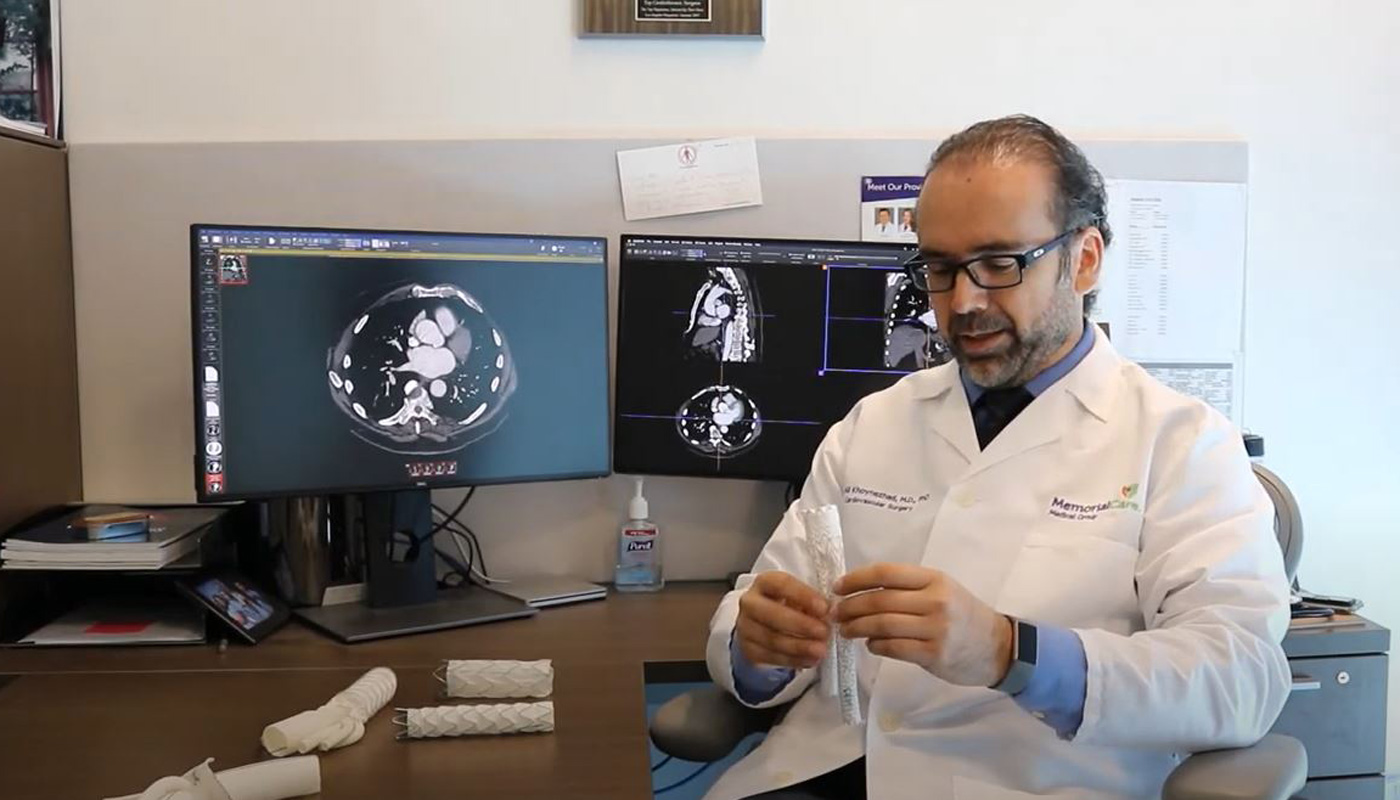 Stents video