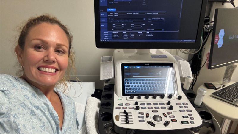 MemorialCare Heart Ultrasound Technician Donates Kidney to Save Brother’s Life